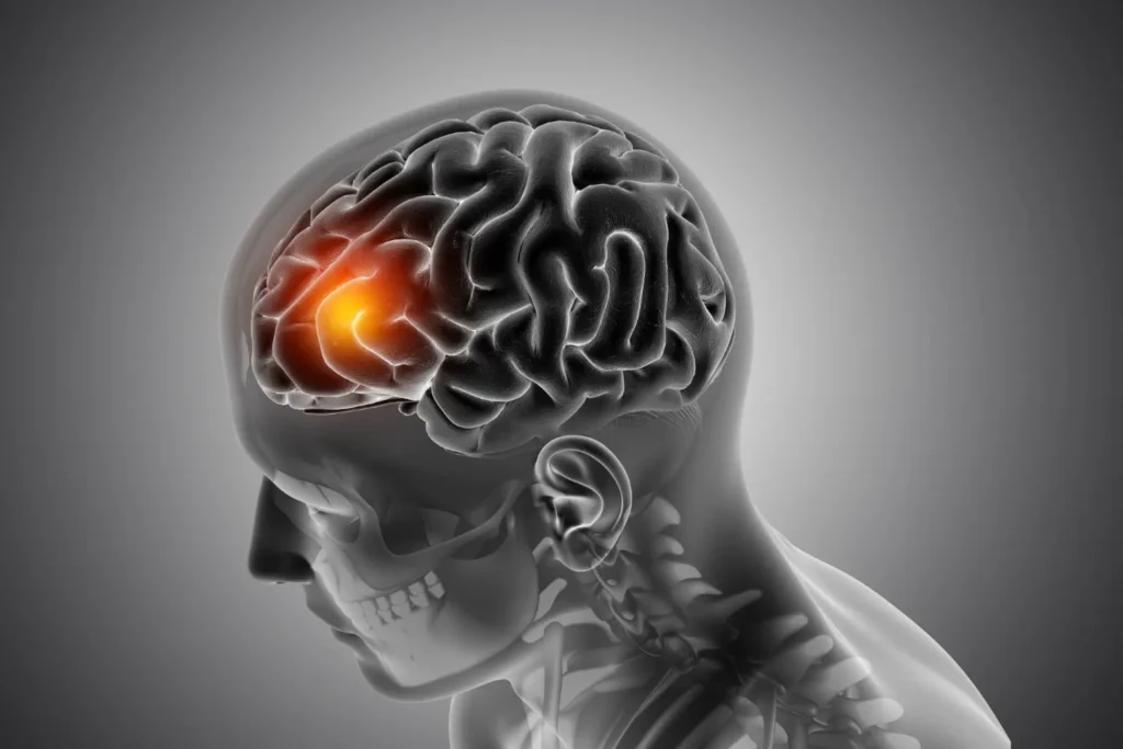Neurodevelopmental Disorders 1024x683